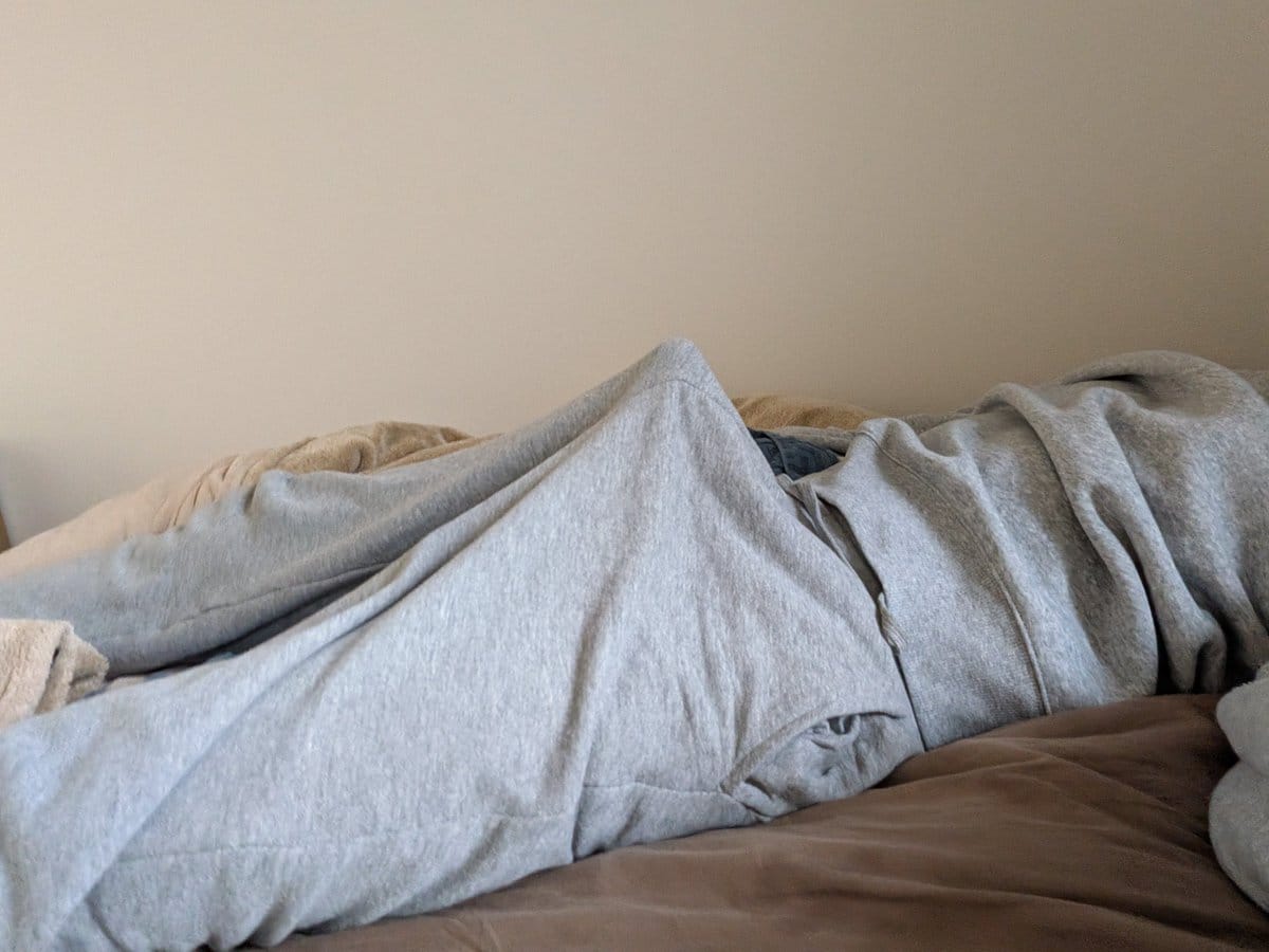 上翘丁丁形状图片鼓包真实分享_1