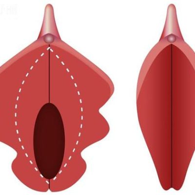 馒头户型和蝴蝶户型哪个好对比图