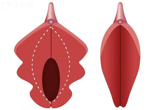 馒头户型和蝴蝶户型哪个好对比图_1